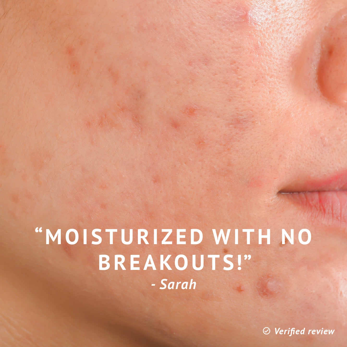 Phluff Moisturizer