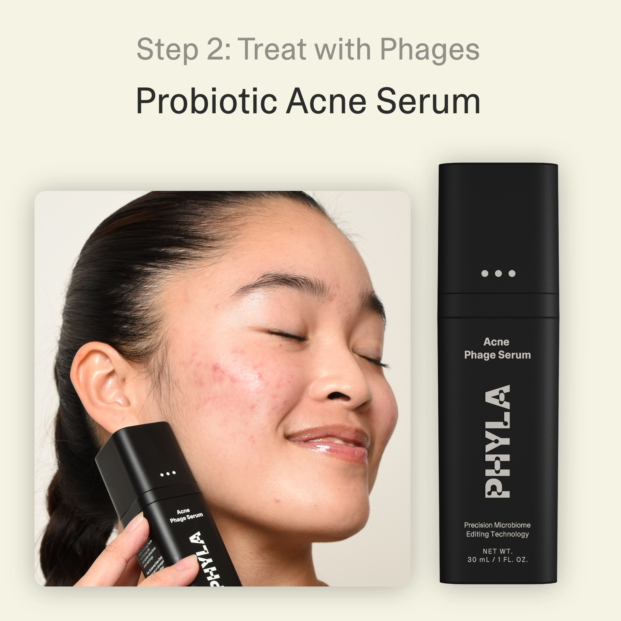 Acne Phage System Main Image