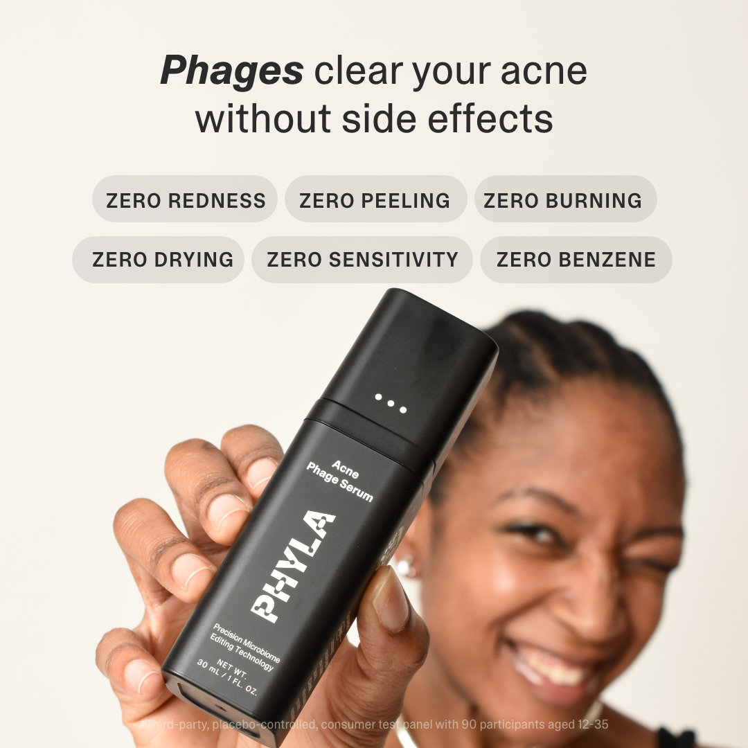 Acne Phage System Main Image