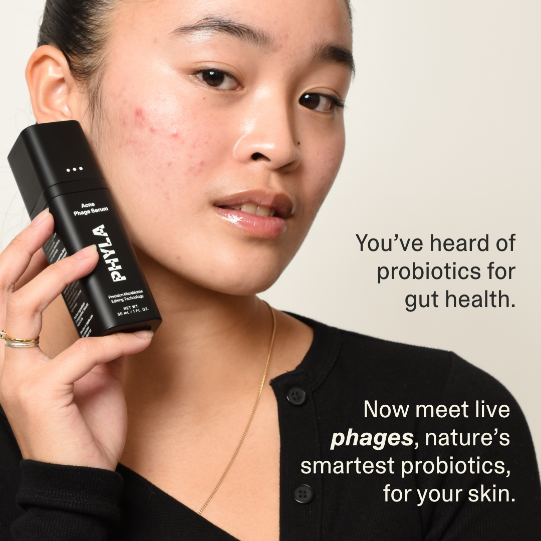 Acne Phage System Main Image
