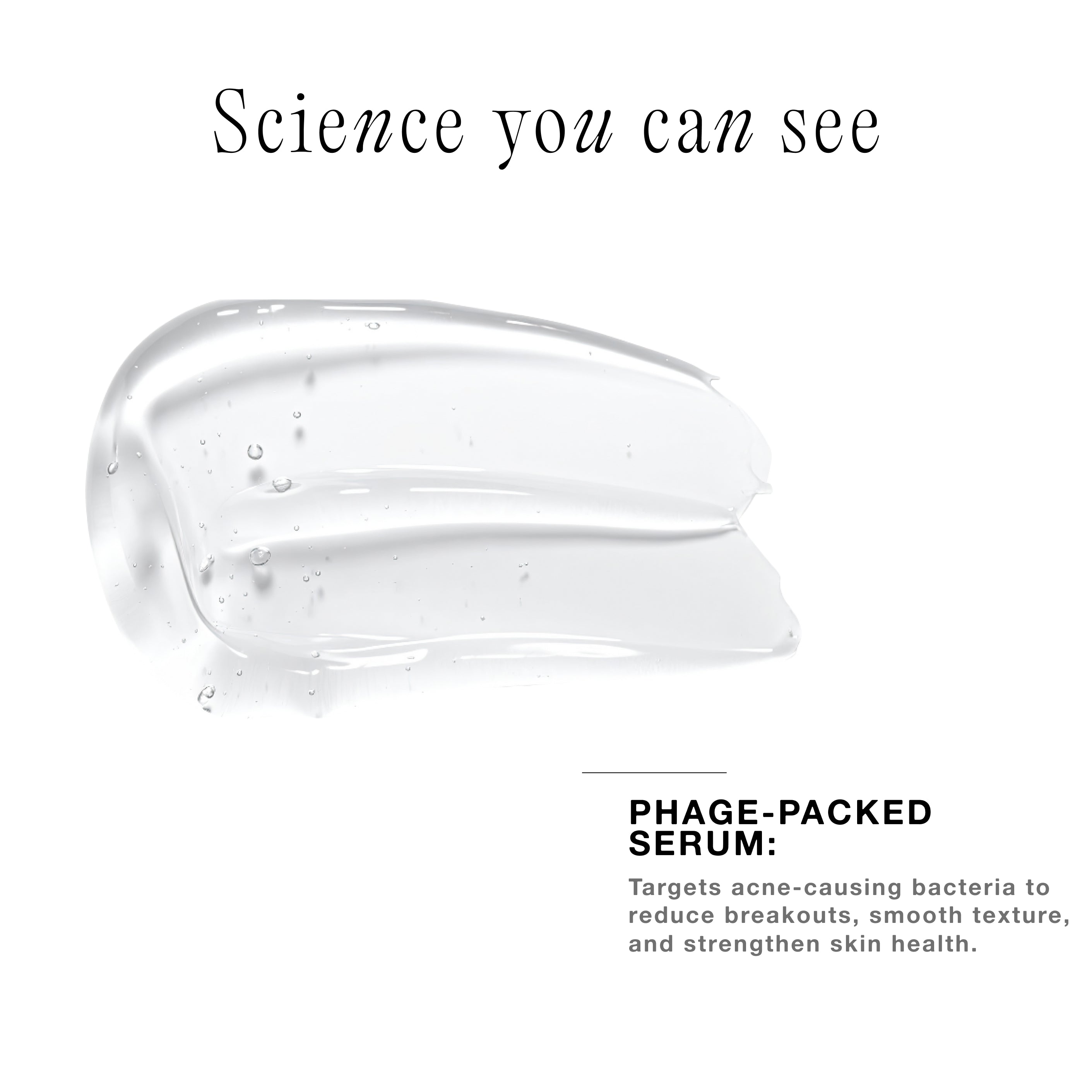 Acne Phage System Main Image