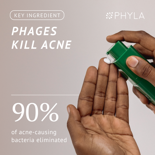 Acne-Fighting Phage System (60 Day Supply)