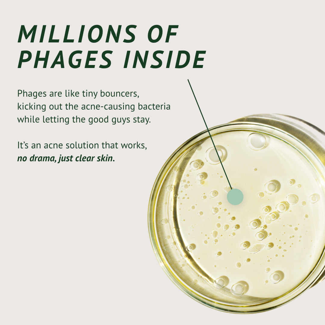 Acne-Fighting Phage System (60 Day Supply)