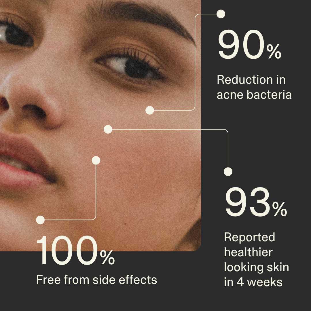 Acne Phage Serum Main Image