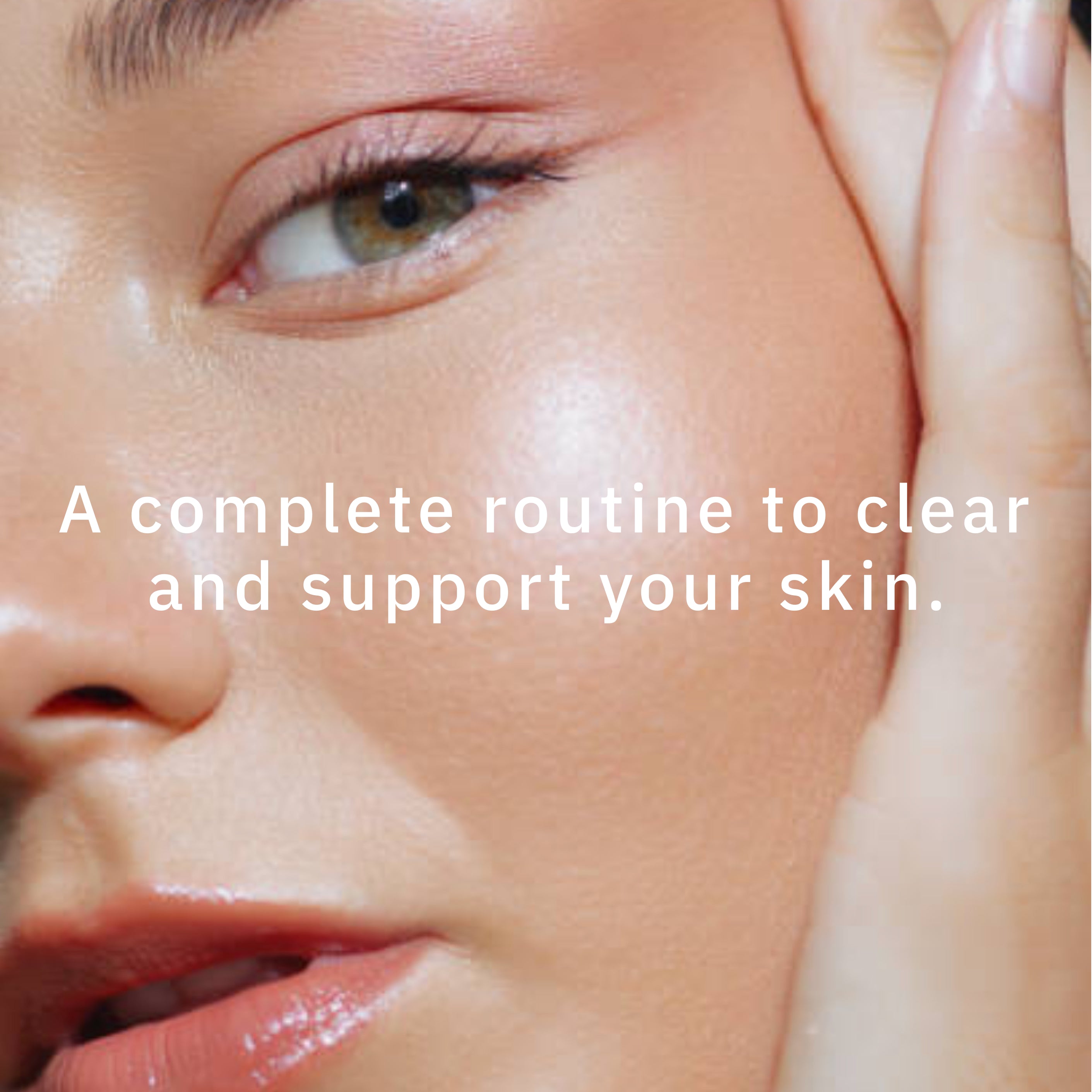 Acne Phage System Main Image