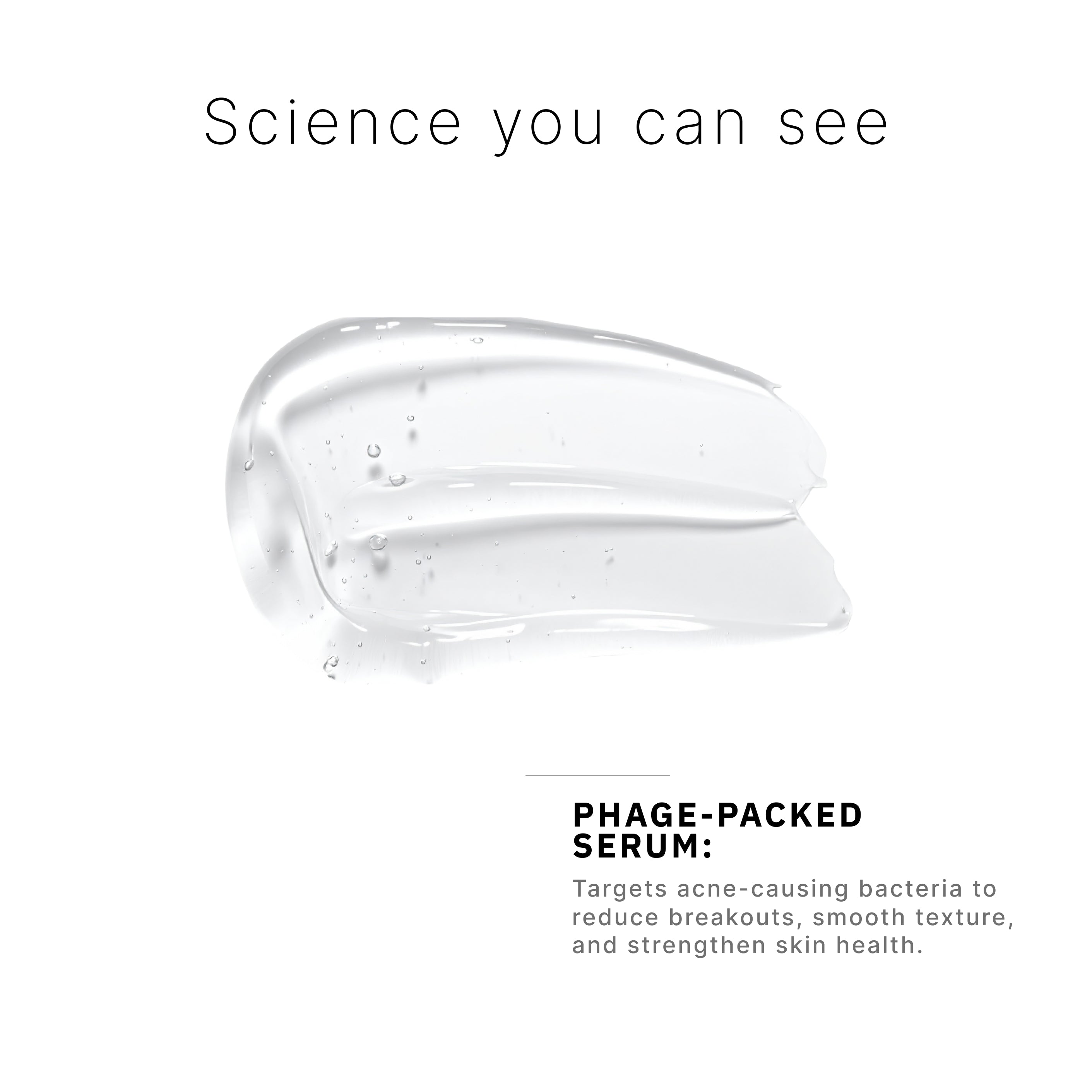 Acne Phage System Main Image