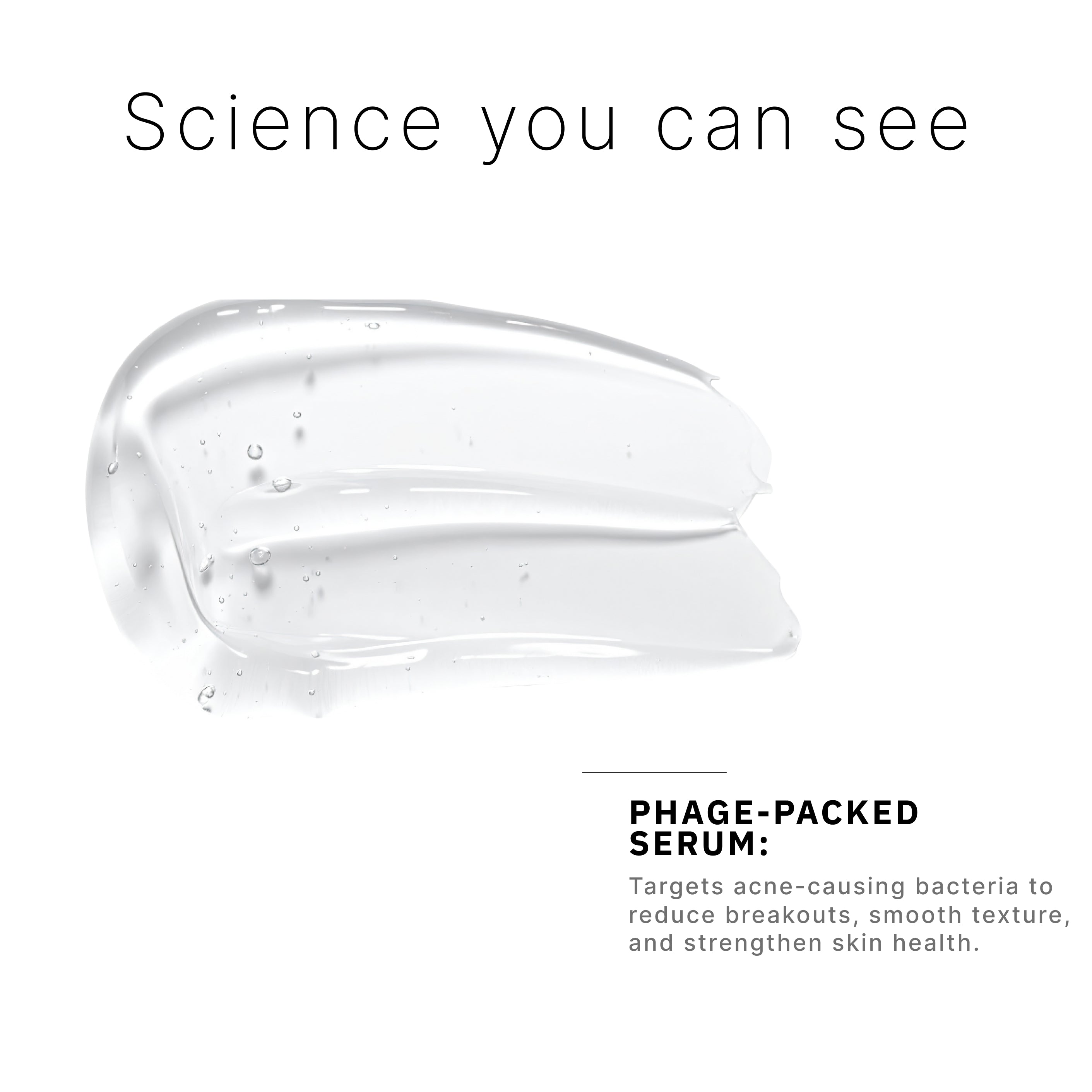 Acne Phage System Main Image