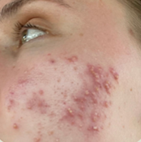 Before Customer Name