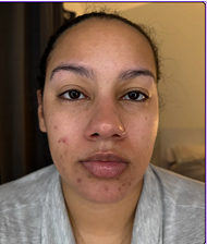 Before Customer Name