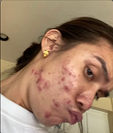 Before Customer Name